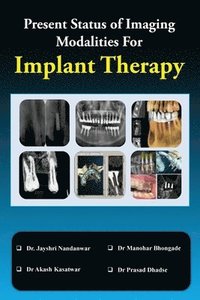 bokomslag Present Status of Imaging Modalities for Implant Therapy