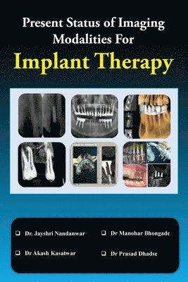 Present Status of Imaging Modalities for Implant Therapy 1