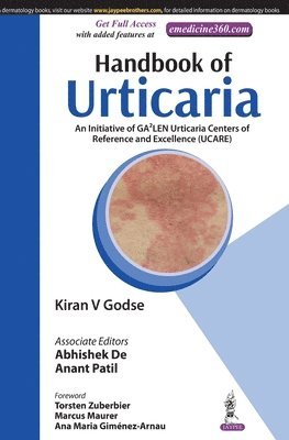 bokomslag Handbook of Urticaria