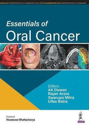 AK Dewan, Rajan Arora, Swarupa Mitra, Ullas Batra - Essentials of Oral Cancer, Häftad. Tillgänglighet: Lägg i varukorg