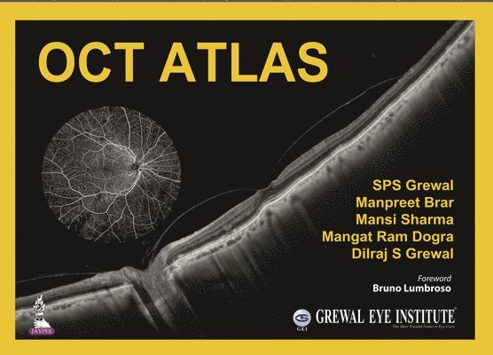 SPS Grewal, Manpreet Brar, Mansi Sharma, Mangat Ram Dogra, Dilraj S Grewal - OCT Atlas, Inbunden