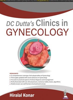 DC Dutta's Clinics in Gynecology 1