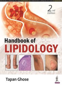 bokomslag Handbook of Lipidology