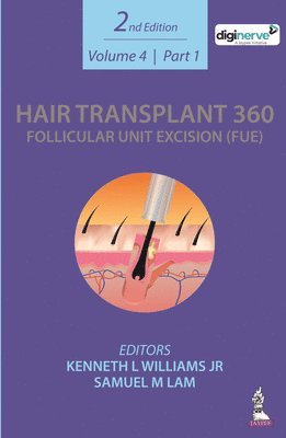 Samuel M Lam, Kenneth L Williams Jr - Hair Transplant 360: Follicular Unit Excision (FUE), Inbunden