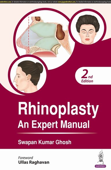 bokomslag Rhinoplasty