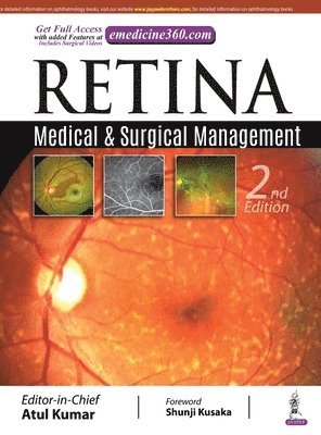 Retina
