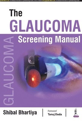 The Glaucoma Screening Manual 1