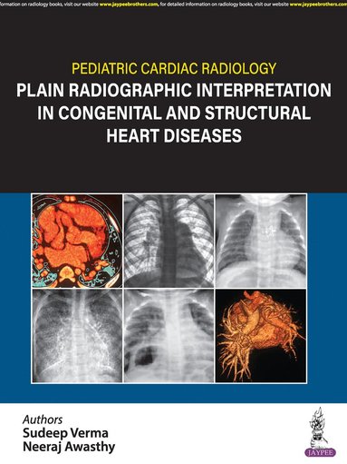 Sudeep Verma, Neeraj Awasthy - Pediatric Cardiac Radiology, Inbunden