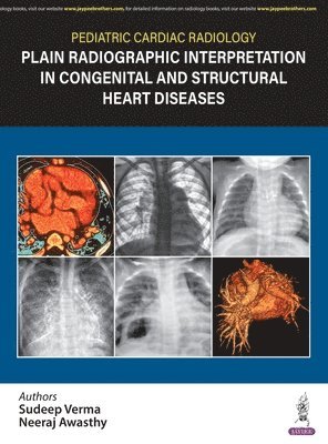 bokomslag Pediatric Cardiac Radiology