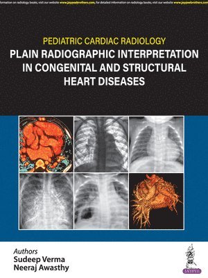 Pediatric Cardiac Radiology 1