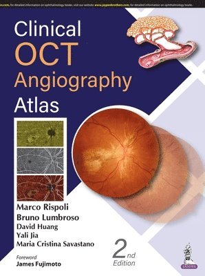 Marco Rispoli, Bruno Lumbroso, David Huang, Yali Jia, Maria Cristina Savastano - Clinical OCT Angiography Atlas, Inbunden