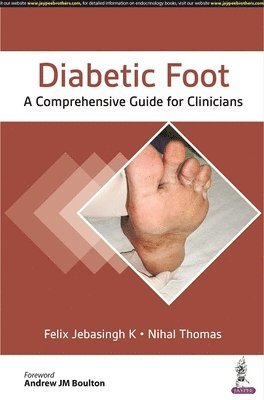 Diabetic Foot 1