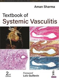 bokomslag Textbook of Systemic Vasculitis