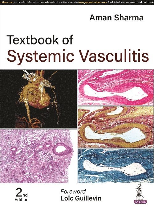 Aman Sharma - Textbook of Systemic Vasculitis, Inbunden