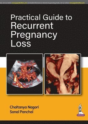 bokomslag Practical Guide to Recurrent Pregnancy Loss