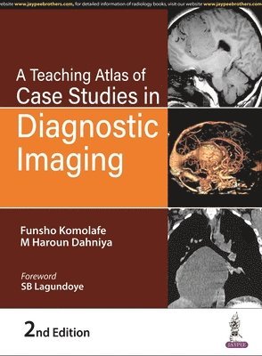bokomslag A Teaching Atlas of Case Studies in Diagnostic Imaging