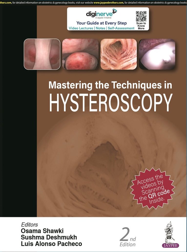 Mastering the Techniques in Hysteroscopy 1