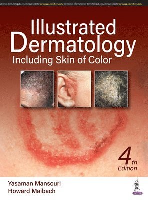 bokomslag Illustrated Dermatology