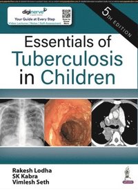 bokomslag Essentials of Tuberculosis in Children