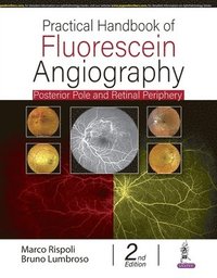 bokomslag Practical Handbook of Fluorescein Angiography