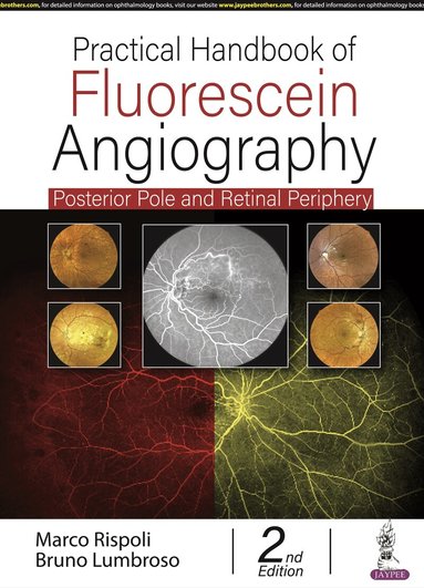 Marco Rispoli, Bruno Lumbroso - Practical Handbook of Fluorescein Angiography, Inbunden