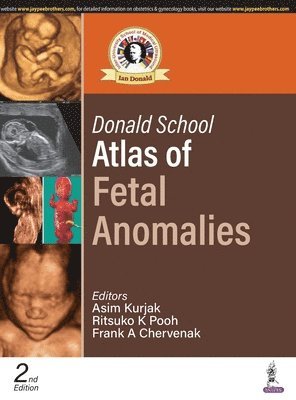 Donald School Atlas of Fetal Anomalies 1