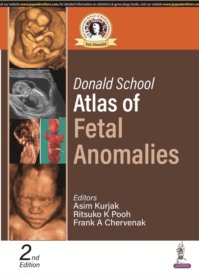 Asim Kurjak, Ritsuko K Pooh, Frank A Chervenak - Donald School Atlas of Fetal Anomalies, Häftad