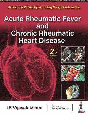 Acute Rheumatic Fever and Chronic Rheumatic Heart Disease 1