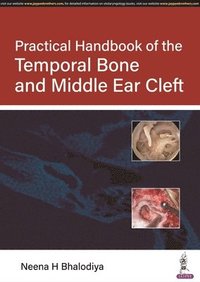 bokomslag Practical Handbook of the Temporal Bone and Middle Ear Cleft