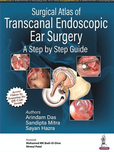 Arindam Das, Sandipta Mitra, Sayan Hazra - Surgical Atlas of Transcanal Endoscopic Ear Surgery, Inbunden