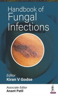 bokomslag Handbook of Fungal Infections