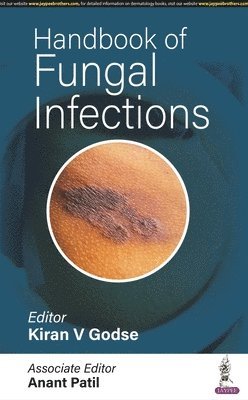 Handbook of Fungal Infections 1