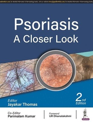 bokomslag Psoriasis