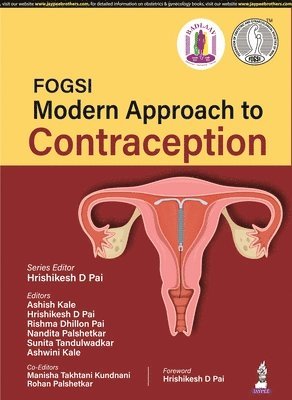 FOGSI: Modern Approach to Contraception 1