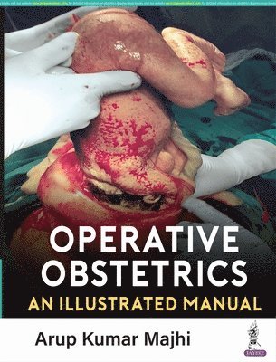 Operative Obstetrics 1