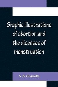 bokomslag Graphic illustrations of abortion and the diseases of menstruation; Consisting of Twelve Plates from Drawings Engraved on Stone, and Coloured by Mr. J. Perry, and Two Copper-plates from the