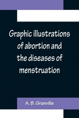 Graphic illustrations of abortion and the diseases of menstruation; Consisting of Twelve Plates from Drawings Engraved on Stone, and Coloured by Mr. J. Perry, and Two Copper-plates from the 1