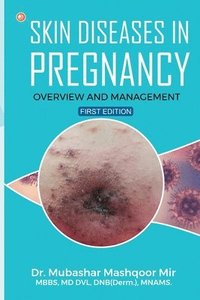 bokomslag Skin Diseases in Pregnancy: Overview and Management