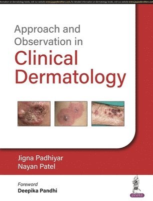 Jigna Padhiyar, Nayan Patel - Approach and Observation in Clinical Dermatology, Häftad