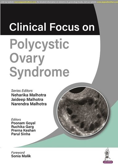 Neharika Malhotra, Jaideep Malhotra, Narendra Malhotra - Clinical Focus on Polycystic Ovary Syndrome, Häftad