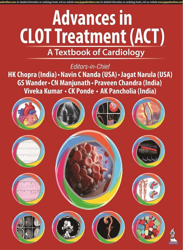 HK Chopra, Navin C Nanda, Jagat Narula, GS Wander, CN Manjunath, Praveen Chandra, Viveka Kumar, CK Ponde, AK Pancholia, Ak Pancholia, Ck Ponde, Cn Manjunath, Gs Wander, Hk Chopra - Advances in CLOT Treatment (ACT), Inbunden