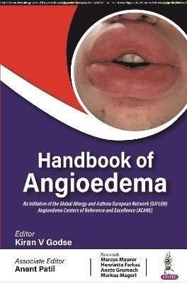 bokomslag Handbook of Angioedema