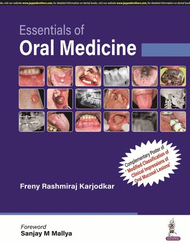 bokomslag Essentials of Oral Medicine