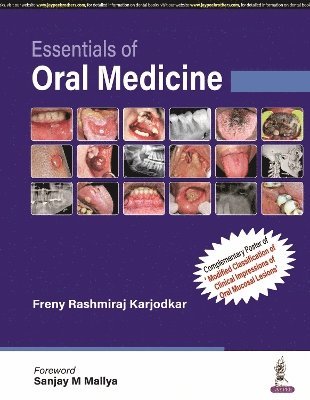 Essentials of Oral Medicine 1