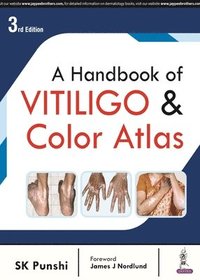 bokomslag A Handbook of Vitiligo & Color Atlas