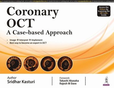 bokomslag Coronary OCT