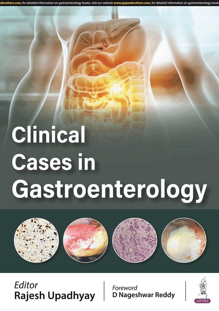 Rajesh Upadhyay - Clinical Cases in Gastroenterology, Häftad