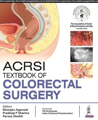 Textbook of Colorectal Surgery 1
