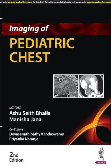 Ashu Seith Bhalla, Manisha Jana, Devasenathipathy Kandaswamy, Priyanka Naranje - Imaging of Pediatric Chest, Häftad