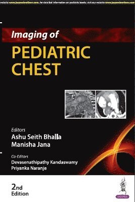 bokomslag Imaging of Pediatric Chest